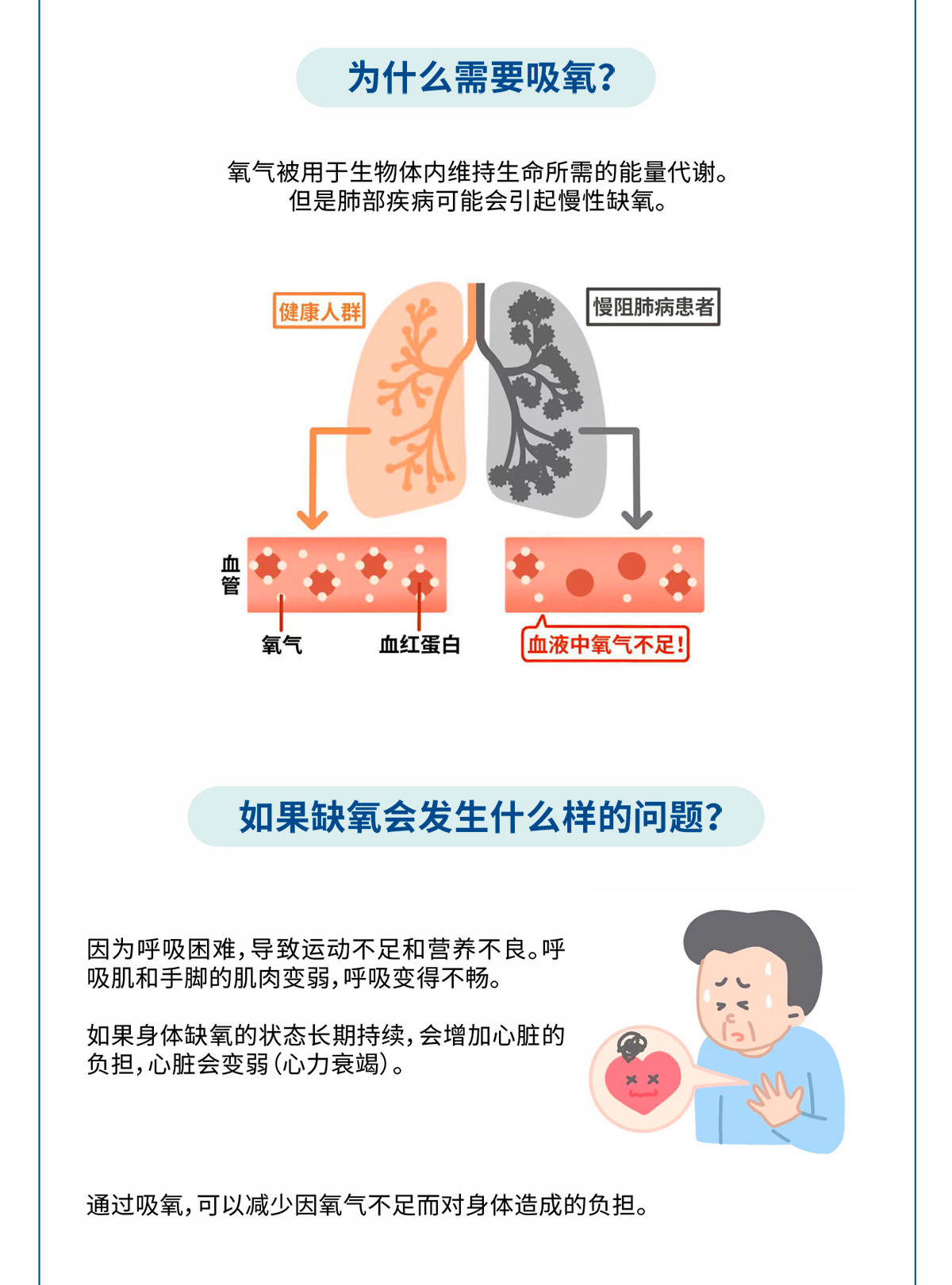 家庭氧疗